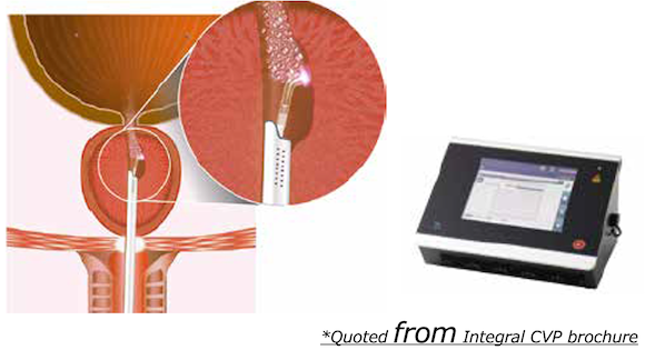 Image of CVP Surgery